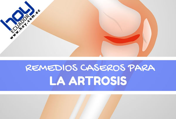 remedios caseros para la artrosis articulaciones inflamadas
