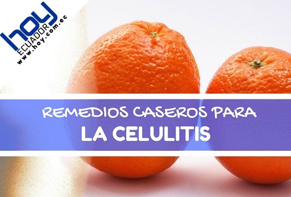 remedios naturales para la celulitis