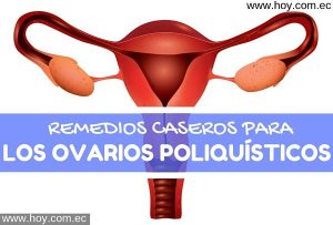 Lee más sobre el artículo Remedios Caseros para los Ovarios Poliquísticos